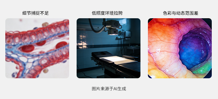 电子阴道镜成像的三大核心难题 电子阴道镜成像的三大核心难题